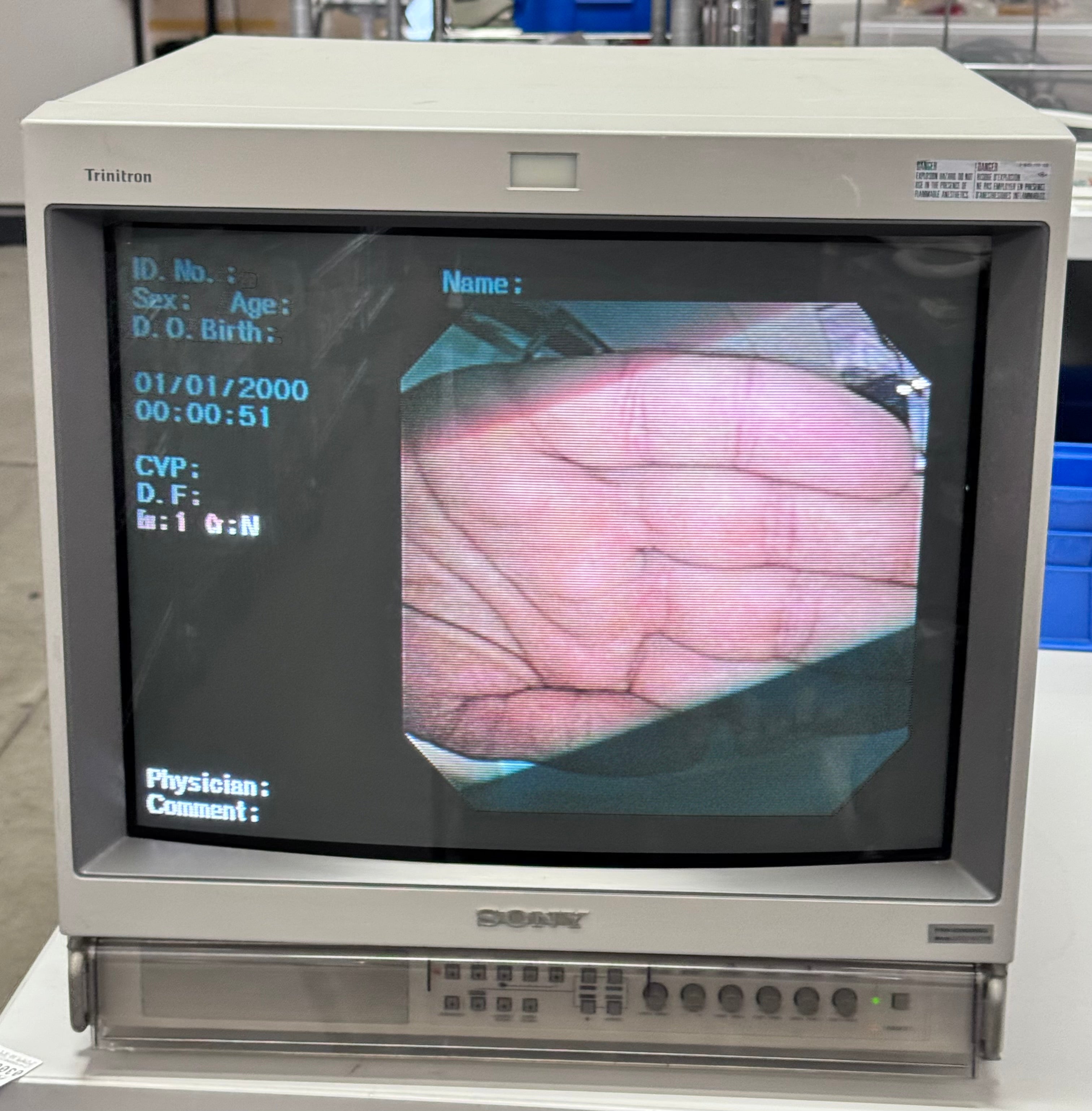 Sony Trinitron PVM-20M2MDU | 20" Medical-Grade Color Video Monitor