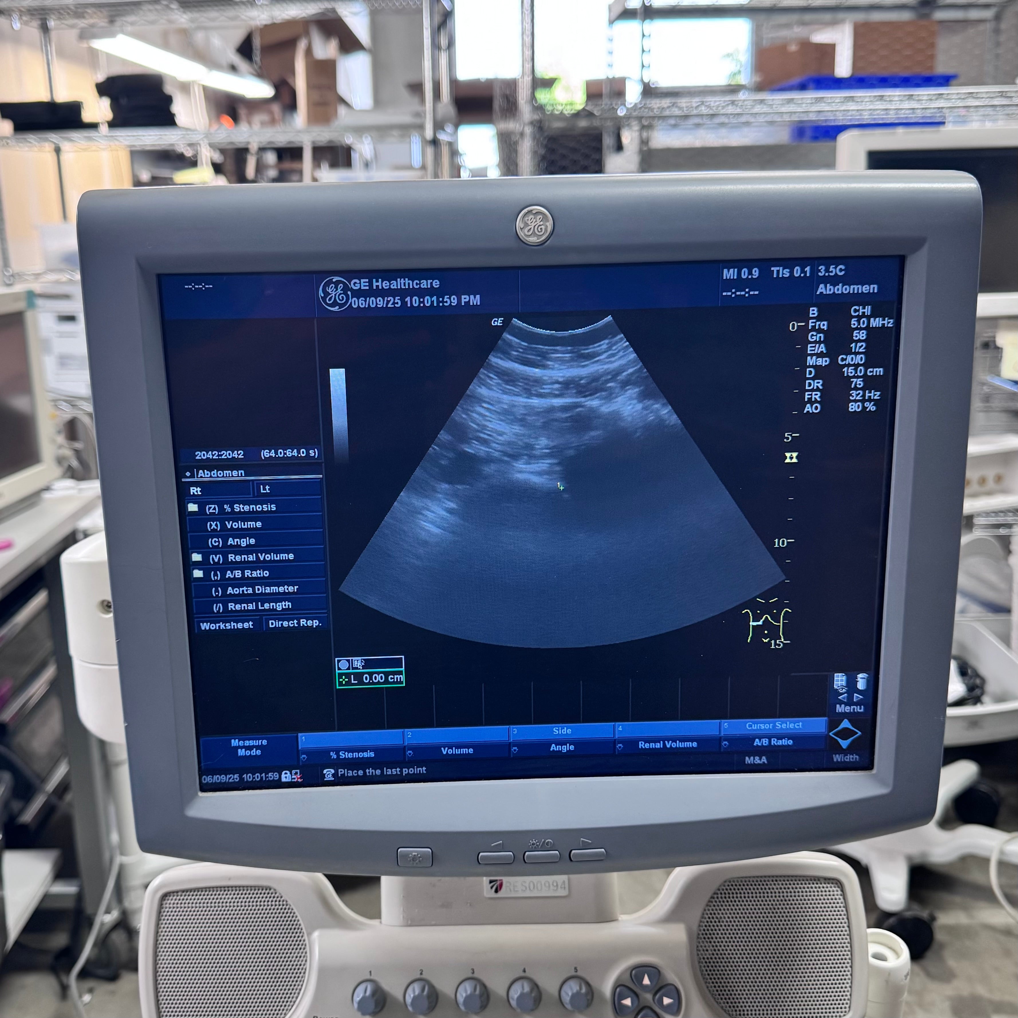 GE Healthcare LOGIQ P5 5266264 | Ultrasound System and 1 Transducer 3.5C