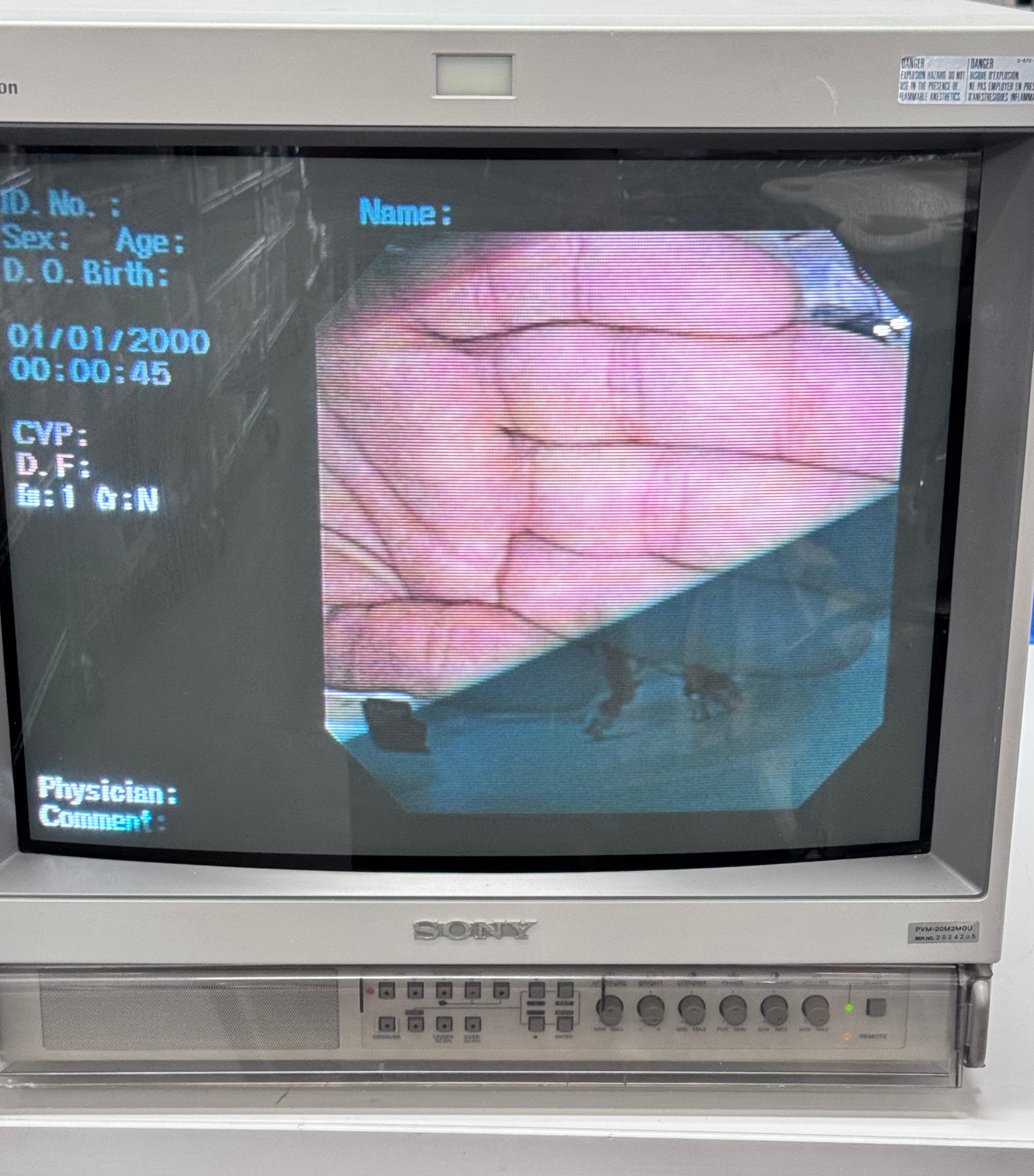 Sony Trinitron PVM-20M2MDU | 20" Medical-Grade Color Video Monitor