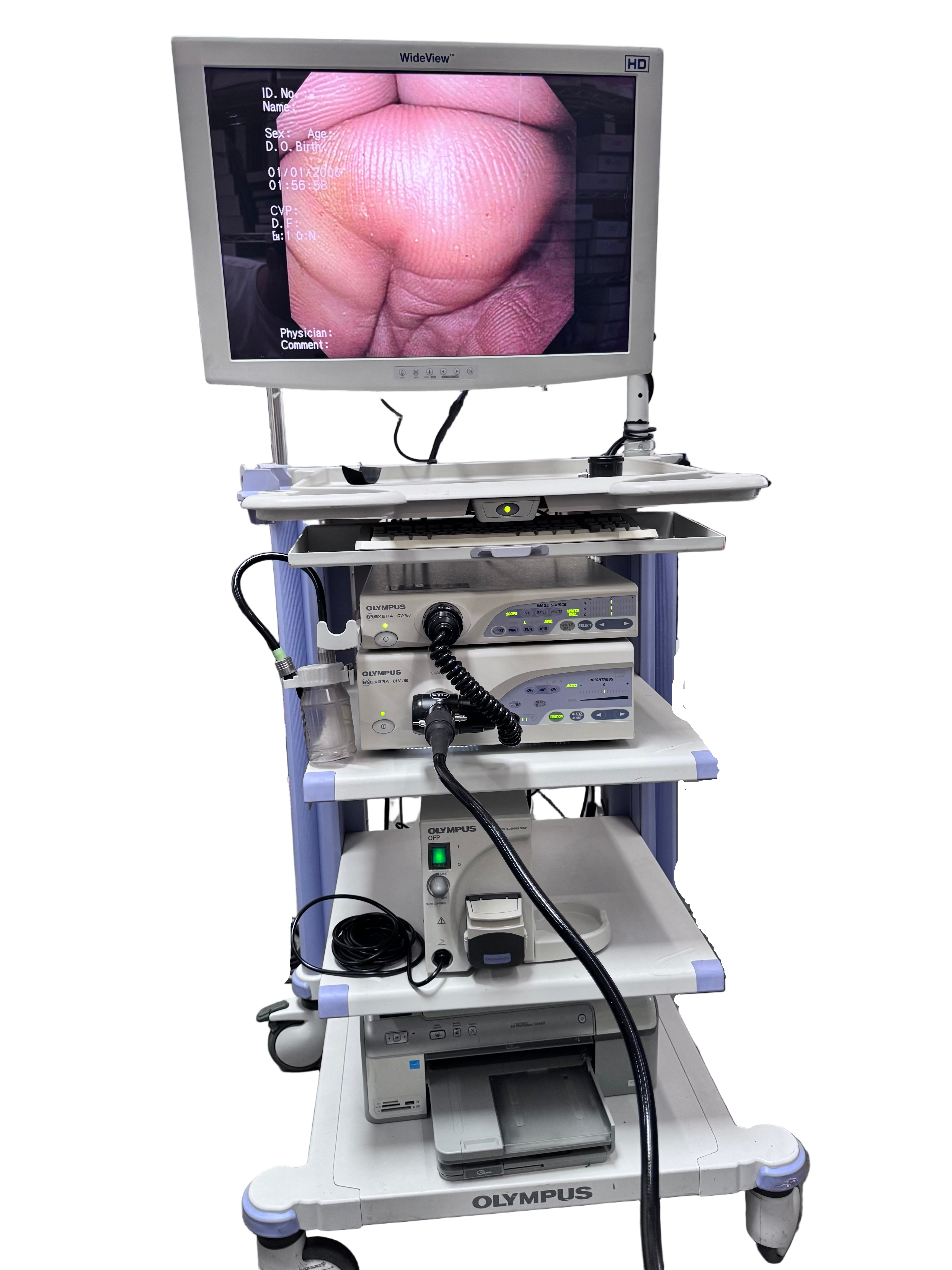 Olympus CV-160 CLV-160 | EVIS EXERA System with Scopes
