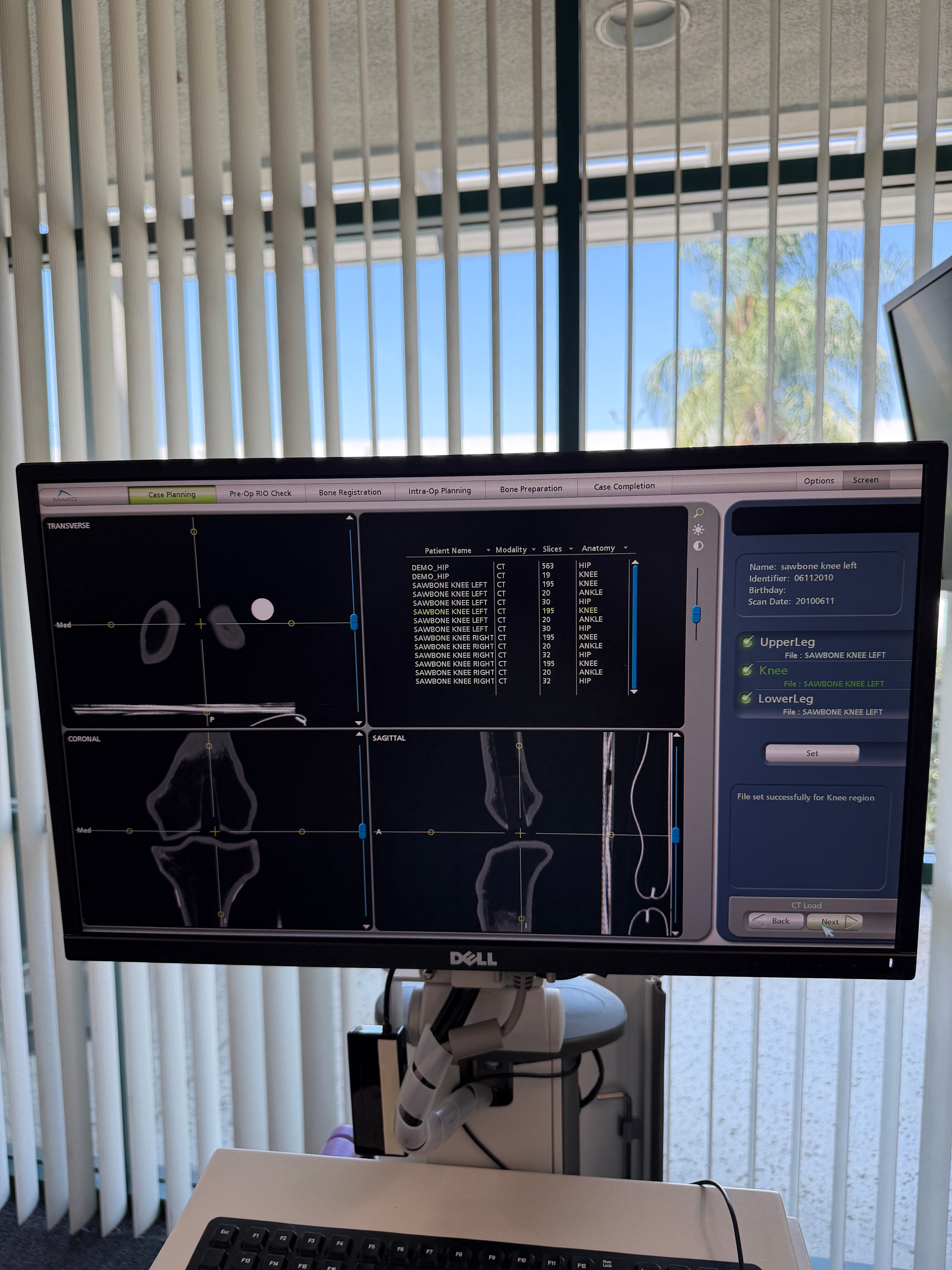 Stryker Mako 209999 | Orthopedic Robotic Arm System - Robot Only