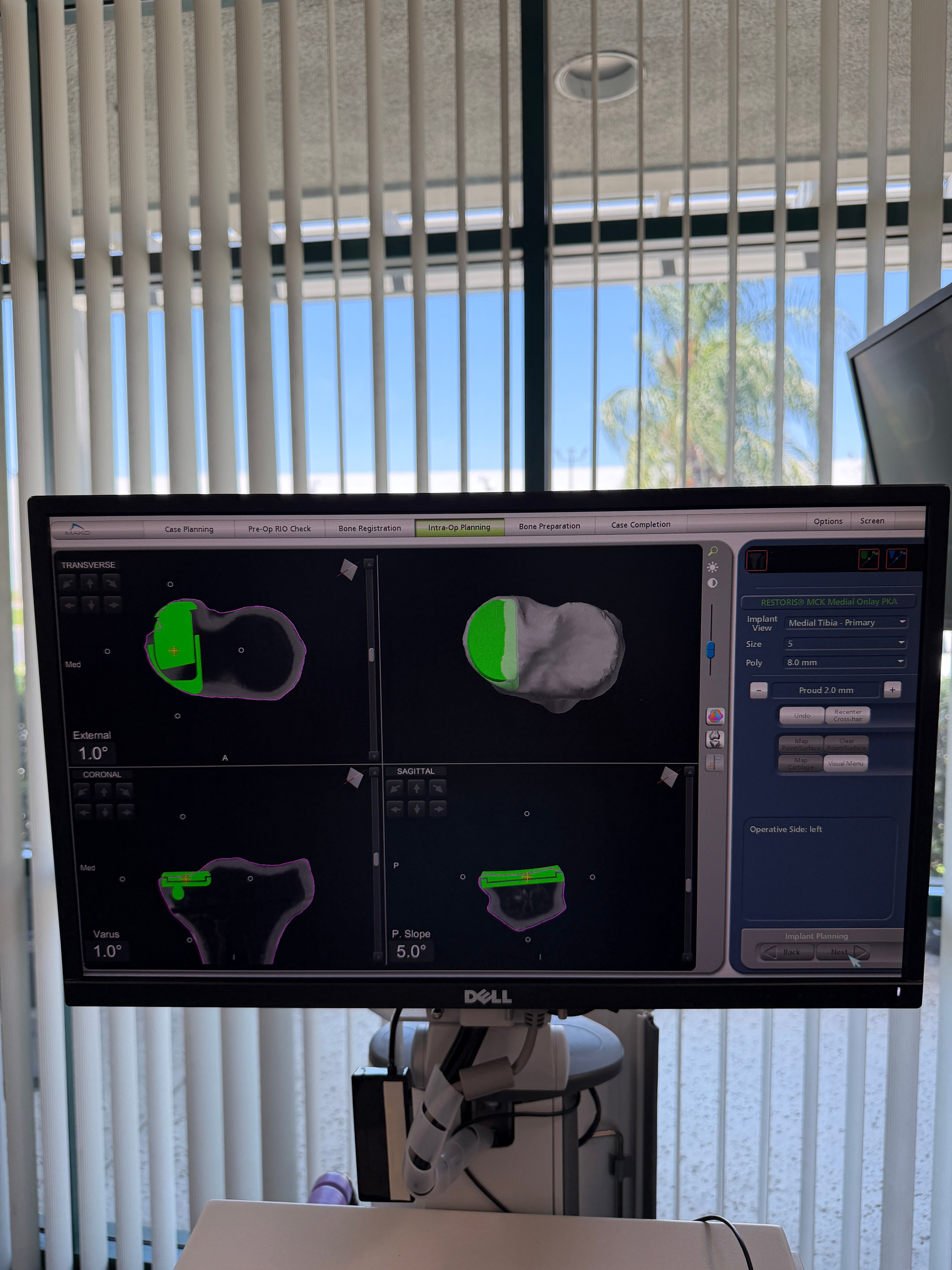 Stryker Mako 209999 | Orthopedic Robotic Arm System - Robot Only